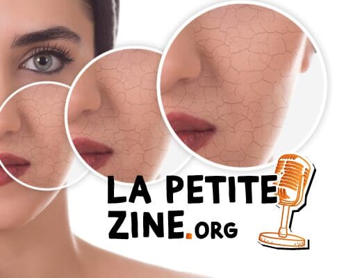 Comment prendre soin d'une peau sèche ? 9
