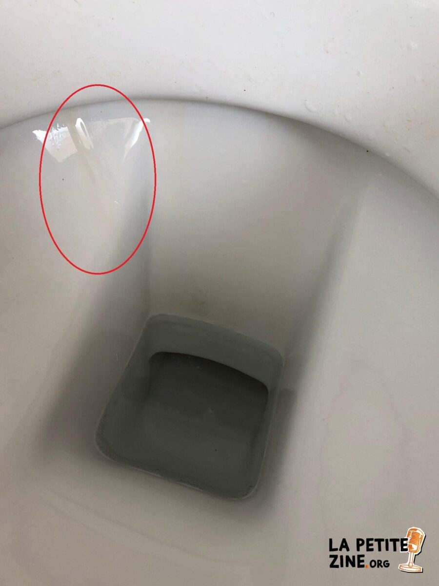 J&rsquo;ai une fuite d&rsquo;eau au plafond : Que faire pour résoudre ce problème ?